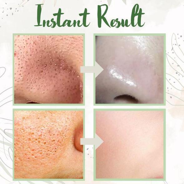 🔥Last Day 49% OFF -🌿Green Tea Deep Cleanse Mask - Gentle. Effective. All-Natural