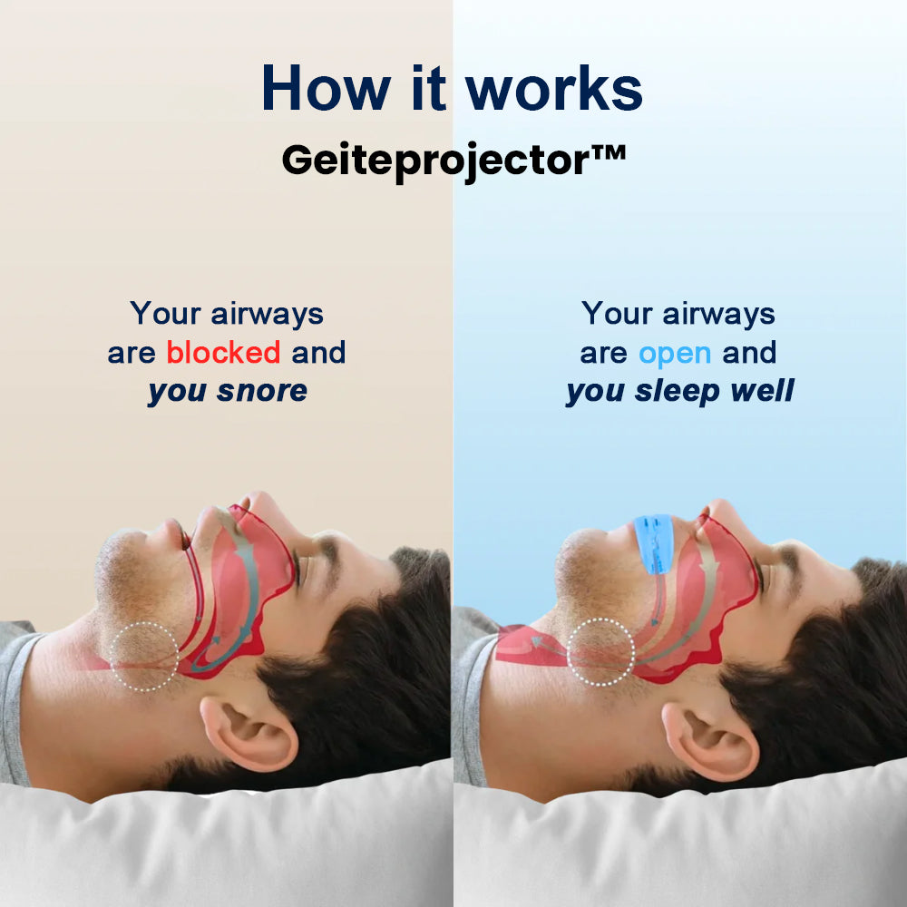 Geiteprojector™  Professional intelligent anti-snoring device