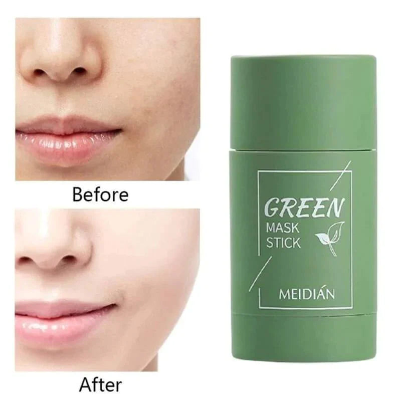 🔥Last Day 49% OFF -🌿Green Tea Deep Cleanse Mask - Gentle. Effective. All-Natural